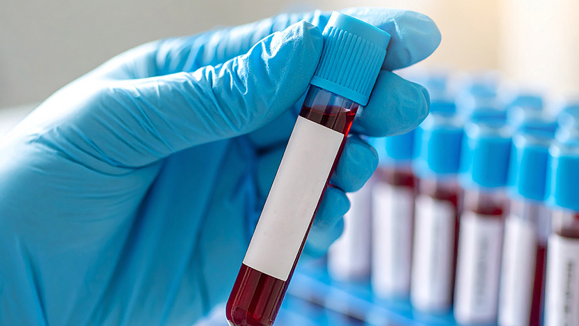 Ist-CBD-im-Blut-nachweisbar